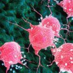 aprea-expands-development-of-wee1-inhibitor-after-seeing-early-clinical-activity-signs-vs.-cancer