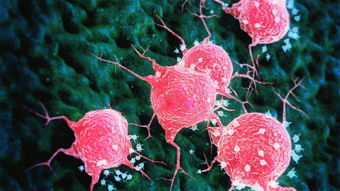 aprea-expands-development-of-wee1-inhibitor-after-seeing-early-clinical-activity-signs-vs.-cancer