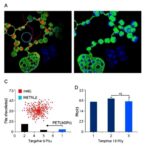 targeting-mettl3/m6a/socs3-reprograms-macrophages,-boosting-anti-pd-1-therapy-in-multiple-myeloma