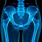 hip-x-ray-indices-may-improve-osteoporosis-screening-before-hip-replacement-in-women