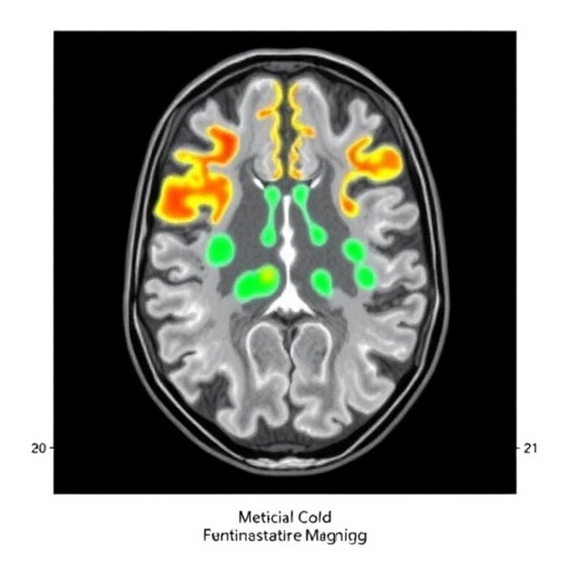 high-contrast-[¹⁸f]sitate-pet/ct-imaging-maps-somatostatin-receptors-in-meningiomas