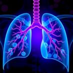 new-predictors-help-stratify-bronchiolitis-obliterans-risk-after-pediatric-stem-cell-transplant