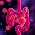 gut-microbe-sugar-molecule-helps-low-protein-diet-fight-pancreatic-cancer
