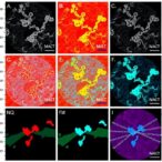 proteomics-maps-spatial-and-molecular-diversity-in-advanced-carotid-artery-plaques