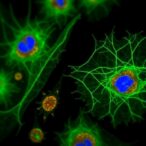 pd-l1-inhibitor-bms-1-injures-keratinocytes:-network-toxicology-reveals-mechanisms