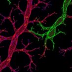 fak-drives-leptin-triggered-vessel-growth-and-mimicry-in-breast-cancer