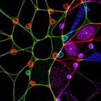 mogrosides-regulate-tumor-metabolism-and-immune-response,-revealing-dual-anticancer-mechanism