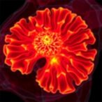 begonia-trial:-durvalumab-plus-trastuzumab-deruxtecan-for-her2-low-metastatic-breast-cancer