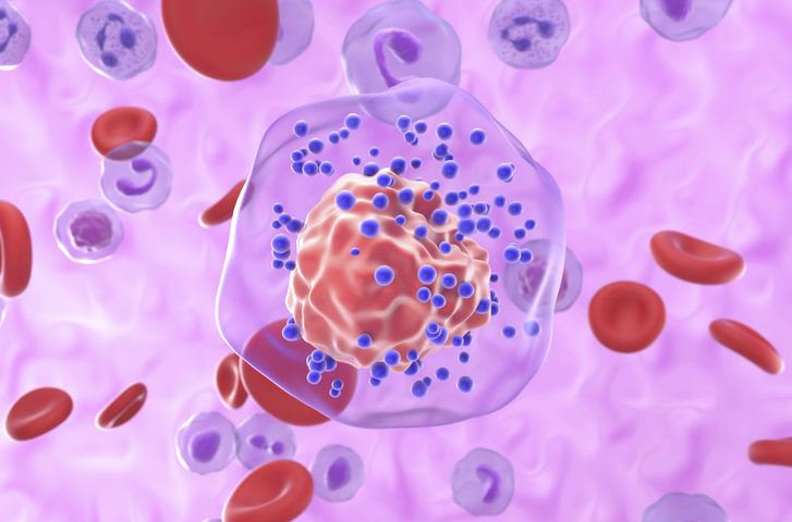 ‘one-two-punch’-targets-resistance-mechanism-in-aggressive-triple-negative-breast-cancer