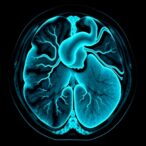variational-autoencoders-detect-coronary-artery-disease-in-spect-images