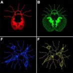 thyroid-cancer-mutations-drive-distinct-dedifferentiation-paths-and-stromal-interactions