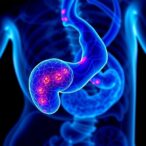 dalpiciclib-with-endocrine-therapy-treats-hr-positive-advanced-breast-cancer-in-visceral-crisis