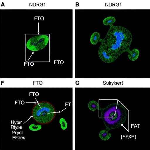 fto-loss-protects-vascular-cells-in-obesity-hypertension-via-ndrg1-methylation