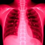 hospital-acquired-pleural-infection-shows-worse-outcomes-than-community-acquired-cases