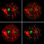 deep-learning-segments-retinal-blood-vessels-in-fluorescein-angiography-images