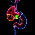 machine-learning-predicts-survival-and-chemotherapy-benefit-in-gastric-cancer
