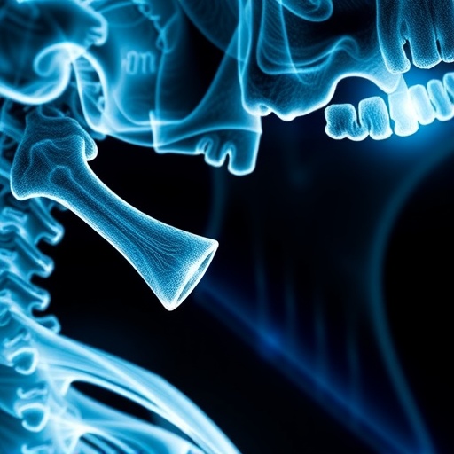 jaw-bone-death-risk-in-osteoporosis-patients-on-antiresorptive-drugs