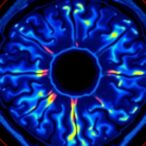 anterior-segment-oct-imaging-predicts-one-year-success-after-preserflo-microshunt-surgery