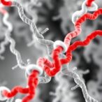 unique-amyloid-β-filament-structure-found-in-app-flemish-mutation-carriers