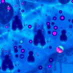 degranulated-eosinophilia-offers-unexpected-diagnostic-clue-for-ectopic-paragonimiasis