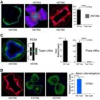 novel-kynureninase-inhibitor-ks79356-slows-triple-negative-breast-cancer-progression