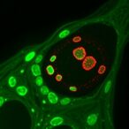 mysm1-halts-cervical-cancer-growth-by-activating-itpr1-driven-autophagy