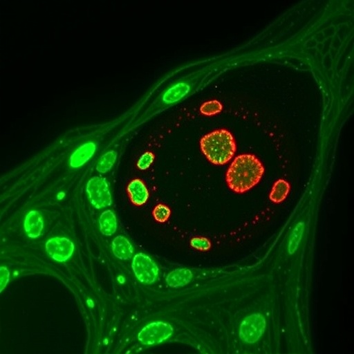 mysm1-halts-cervical-cancer-growth-by-activating-itpr1-driven-autophagy