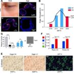 17(s)-hdha-counters-uvb-induced-skin-aging-via-egfr/mapk-pathway-regulation