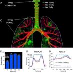 mutant-tp53-traps-foxp3,-disrupting-pd-l1-control-and-fueling-immune-evasion-in-lung-cancer