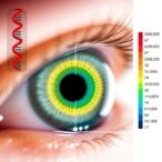 genetic-risk-score-improves-glaucoma-screening-in-large-population-cohort