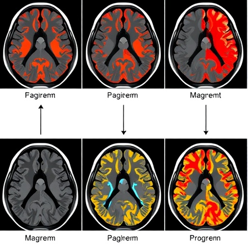 systematic-review-weighs-machine-learning-for-acute-ischemic-stroke-segmentation