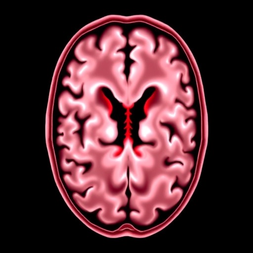 risk-factors-for-shunt-conversion-and-brain-bleeding-after-ventriculosubgaleal-shunts