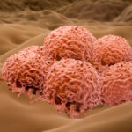 nras-mutations-may-require-mutation-guided-combination-therapies