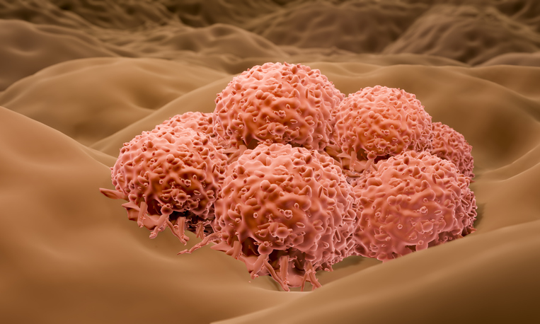nras-mutations-may-require-mutation-guided-combination-therapies