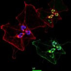 vma21-loss-disrupts-autophagy-and-vesicle-trafficking-in-x-linked-myopathy