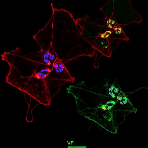 vma21-loss-disrupts-autophagy-and-vesicle-trafficking-in-x-linked-myopathy