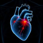 vectorcardiography-enhanced-model-predicts-one-year-cardiac-events-in-heart-failure