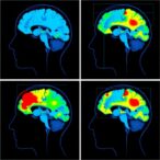 scoping-review-maps-cortical-activation-during-swallowing-tasks-using-fnirs