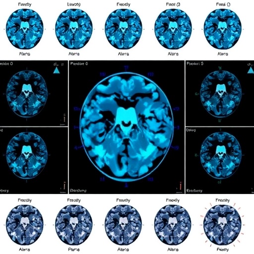 feature-weighted-pcnn-classifies-big-medical-data-efficiently-using-mapreduce