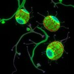 metformin-eases-interferon-driven-dendritic-cell-inflammation-in-stat1-gain-of-function-disease