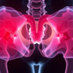muscle-mimicking-conductive-hydrogel-offers-new-hope-for-pelvic-organ-prolapse-repair