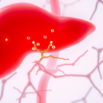 immunotherapy-reshapes-advanced-liver-cancer-care-in-europe,-but-access-lags-behind