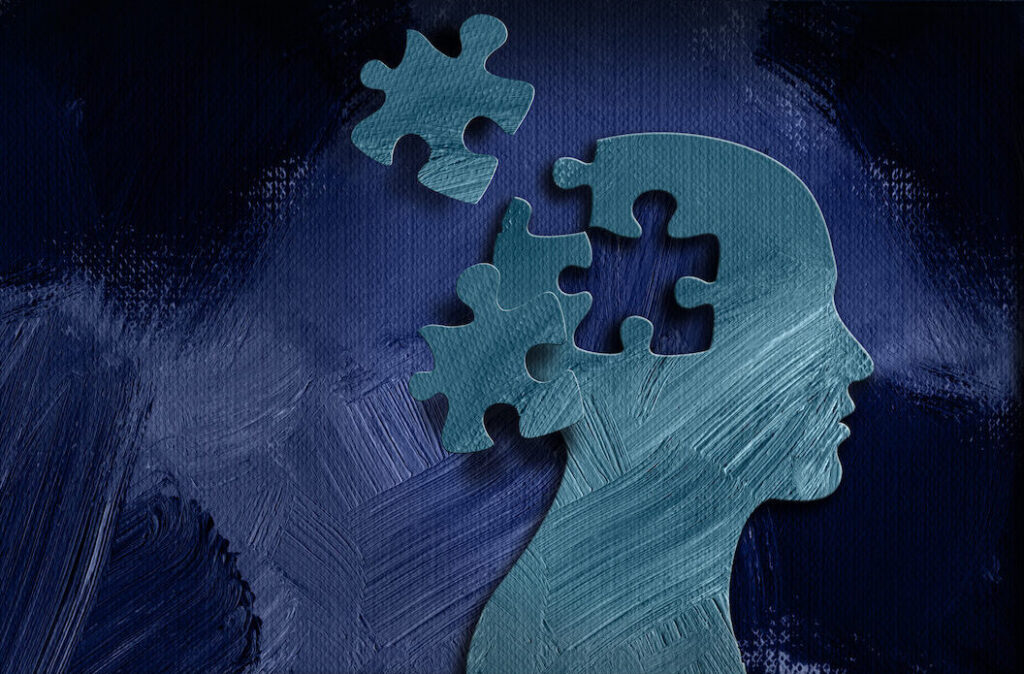 stroke-remodels-tumor-microenvironment-to-promote-glioma-growth
