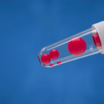 new-mass-spectrometry-assay-tracks-42-obesity-biomarkers-in-a-single-blood-test