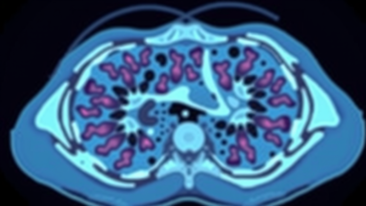 ai-learns-to-read-cancer-slides-like-a-pathologist-by-watching-the-neighborhood