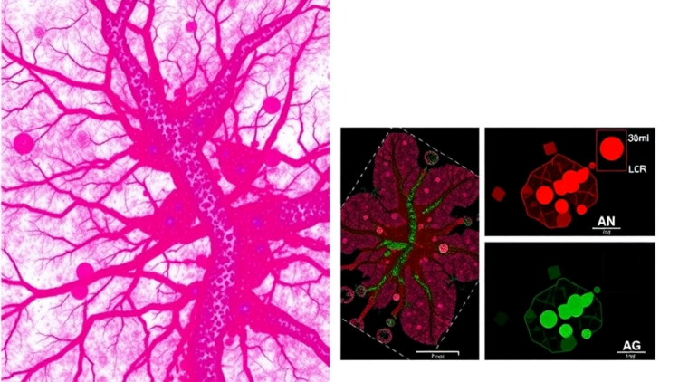 laser-dissected-proteomics-reveals-where-immunity-really-lives-in-triple-negative-breast-tumors