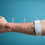 arm-band-electrodes-capture-full-12-lead-ecg-without-chest-wires