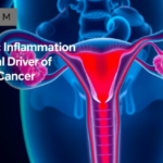 chronic-inflammation-emerges-as-a-central-driver-of-ovarian-cancer-progression