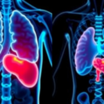 radiation-matches-heat-in-first-head-to-head-trial-for-colorectal-liver-metastases