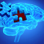 antibody-blocks-t-cell-infiltration-and-limits-neurodegeneration-in-alzheimer’s-mice
